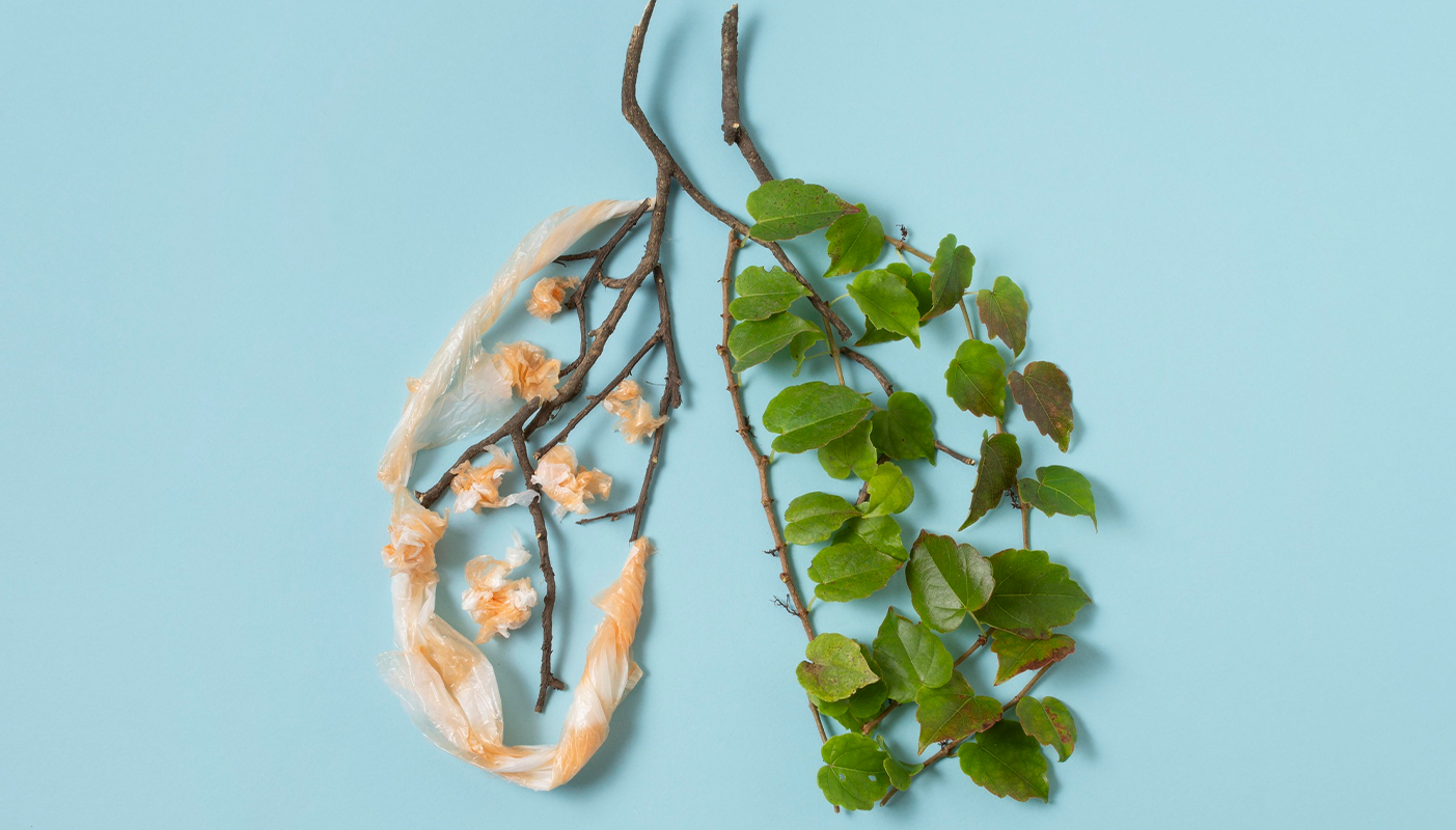 CYSTIC FIBROSIS: UNRAVELING THE MYSTERY OF A COMPLEX GENETIC DISORDER