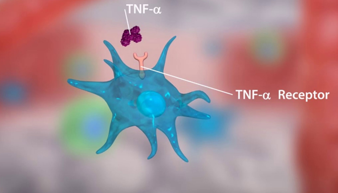 EARLY DETECTION FACILITATES THE TREATMENT OF GENETIC DISEASES CAUSED BY TNF α GENE MUTATION